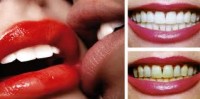 LOCATION BAR A SOURIRE